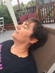 Head of a reclining woman with 5 small acupuncture needles in her left ear